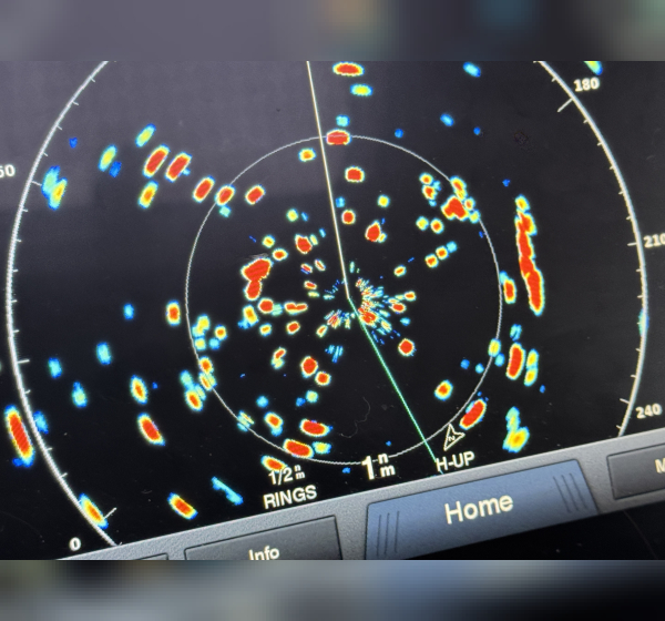 Radar