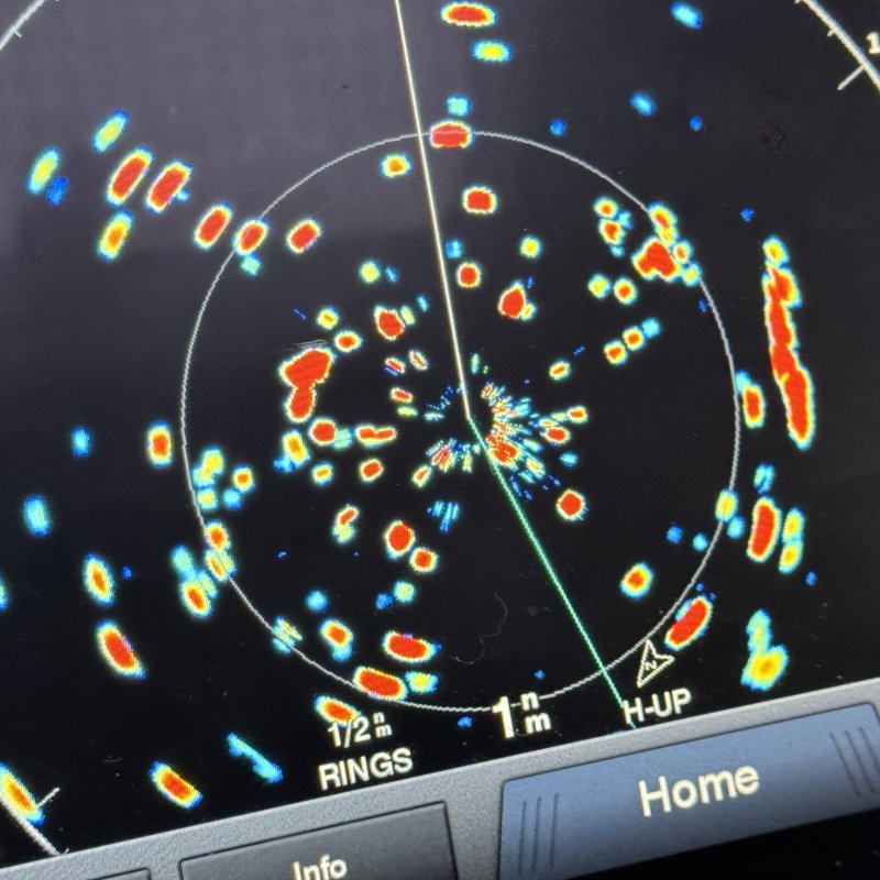 Radar